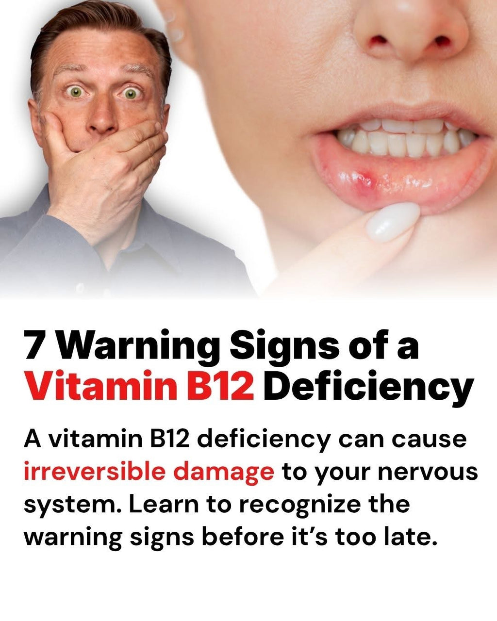 Vitamin B-12 (10ml) – Home Use Formula